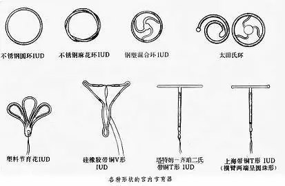 避孕环不锈钢环和铜环的区别