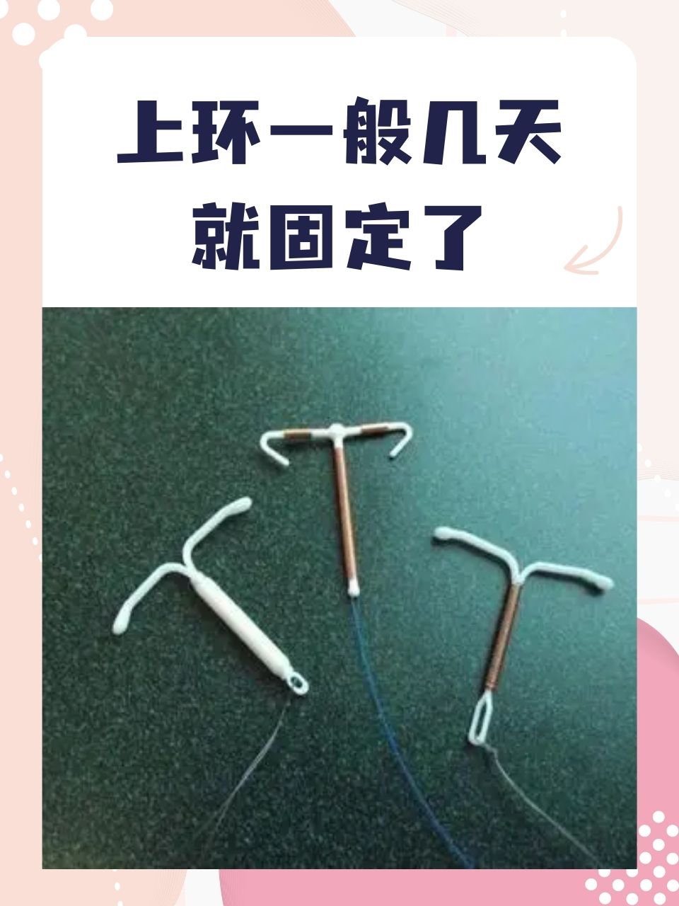 上圆形环避孕效果好吗