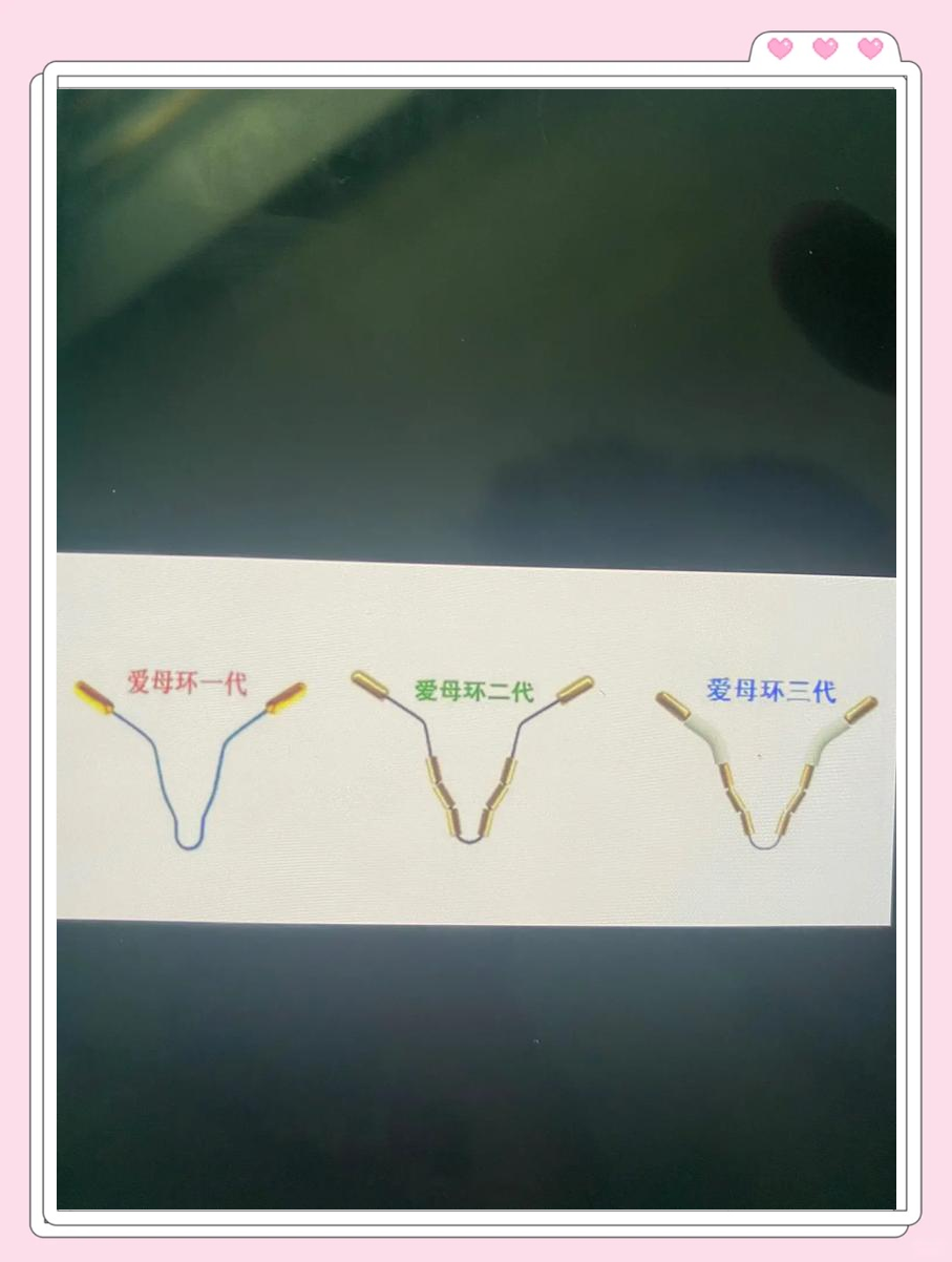 上环后是不是很随意了呢_上环后是不是很随意了