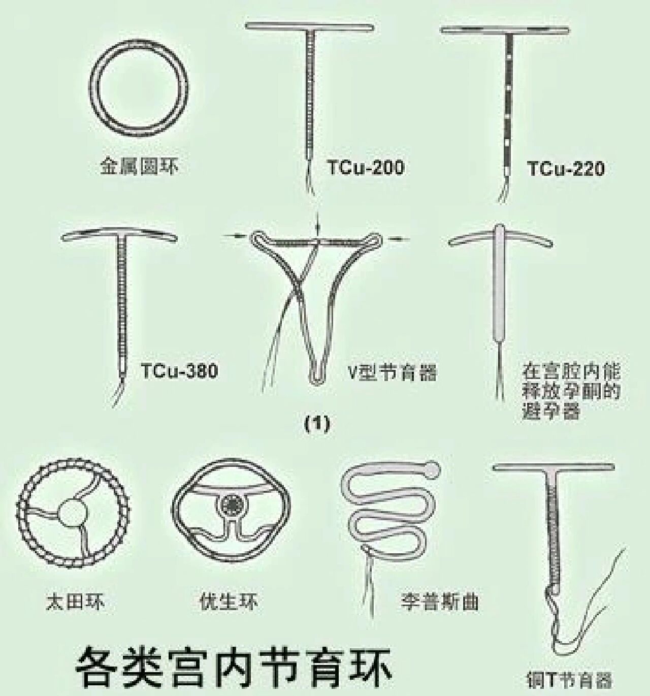 节育环不锈钢圆环的使用年限
