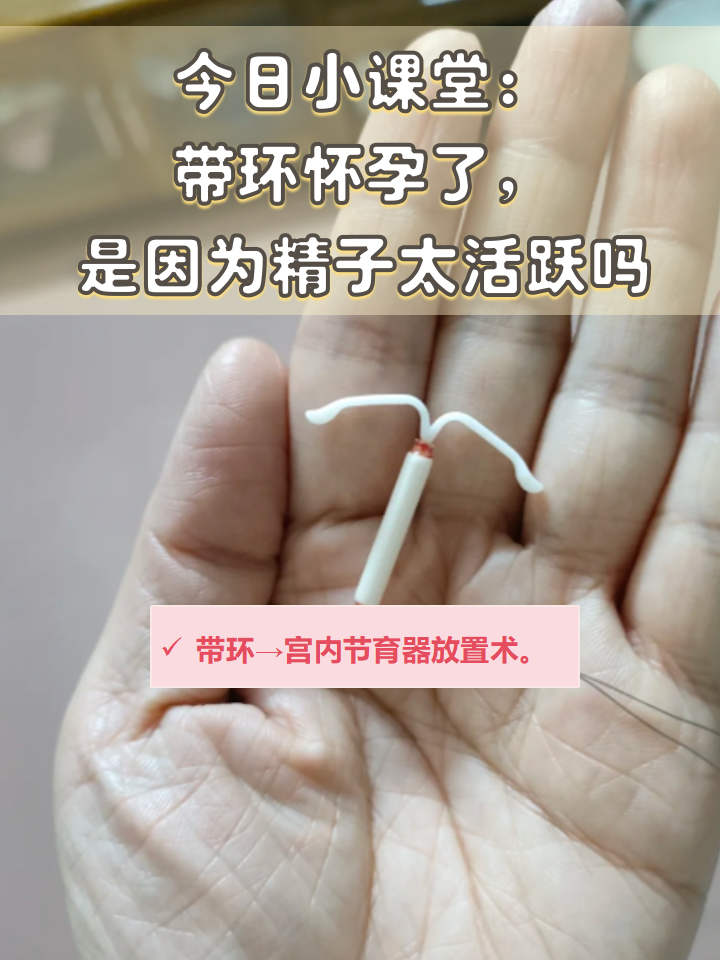 国产节育环与进口节育环的优缺点分析