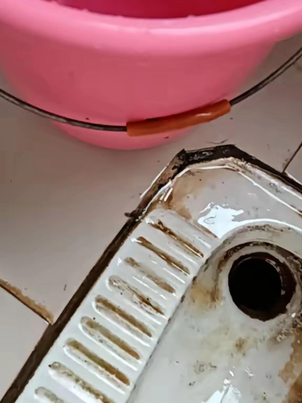 洁厕液把不锈钢烧黑了 吸入中毒