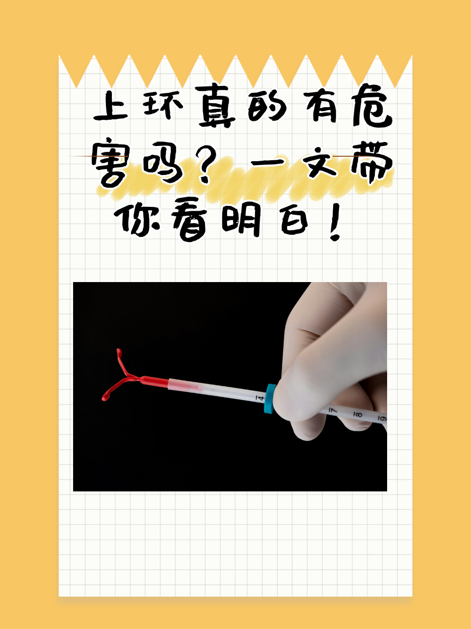 上什么环最好最安全伤害小图片