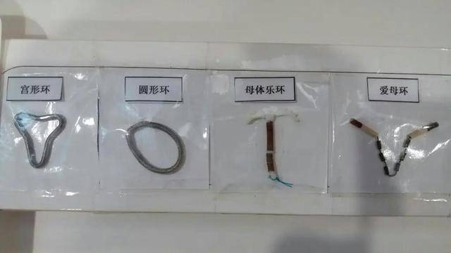带环脱落自己能感觉到吗女性